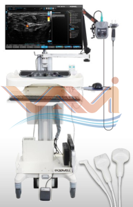 điện cơ tích hợp siêu âm thần kinh cơ